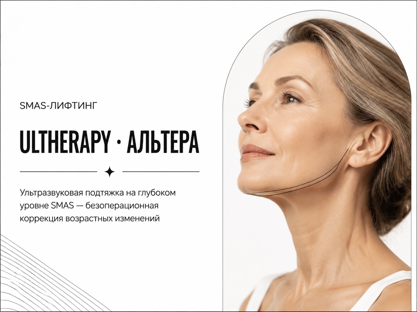 Ultherapy Альтера ультразвуковой SMAS-лифтинг в Мурманске — скидка 25%