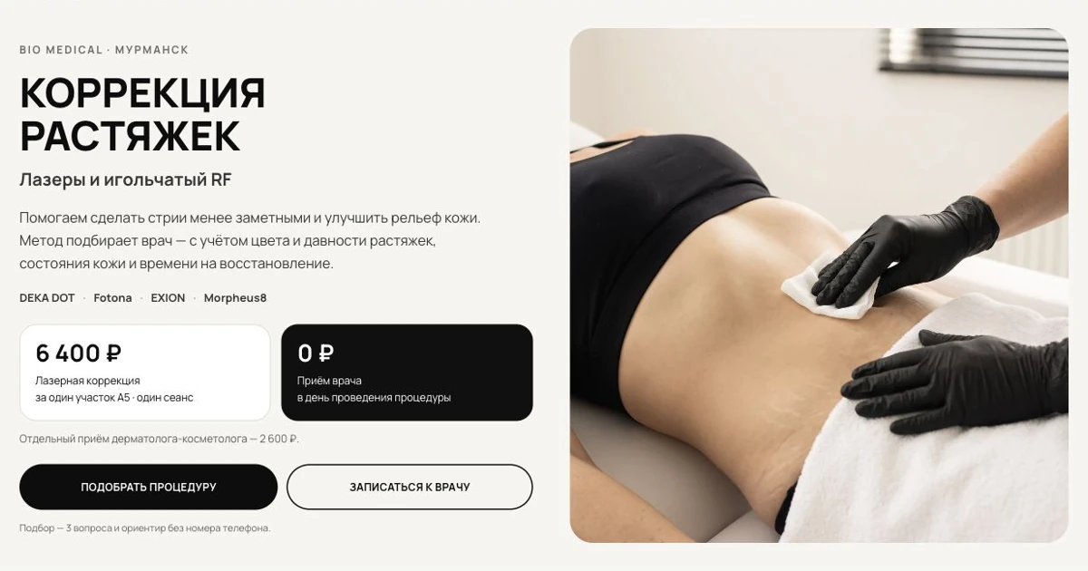 Коррекция растяжек в BIO MEDICAL — методы и стоимость